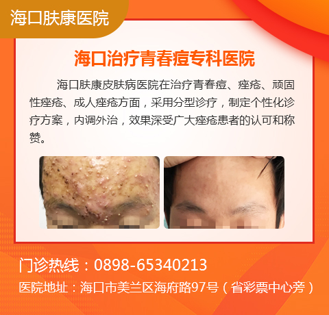 痘痘为何反复出现在一个部位?